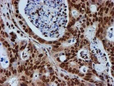 Immunohistochemistry: FMRP Antibody (OTI3B4) - Azide and BSA Free [NBP2-70761]