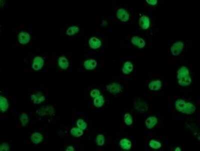 Immunofluorescence: FMRP Antibody (OTI3B4) [NBP2-45689]