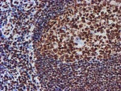 Immunohistochemistry: FMRP Antibody (OTI3B4) [NBP2-45689]