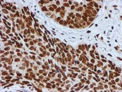 Immunohistochemistry: FMRP Antibody (OTI3B4) [NBP2-45689]