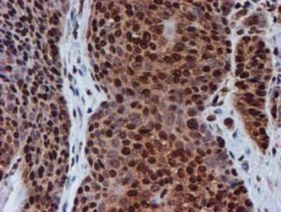 Immunohistochemistry: FMRP Antibody (OTI3B4) [NBP2-45689]