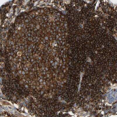 Immunohistochemistry-Paraffin: FNBP1 Antibody [NBP2-48542]