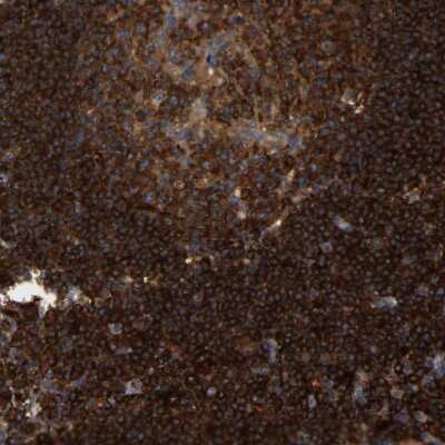 Immunohistochemistry-Paraffin: FNBP1 Antibody [NBP2-48542]