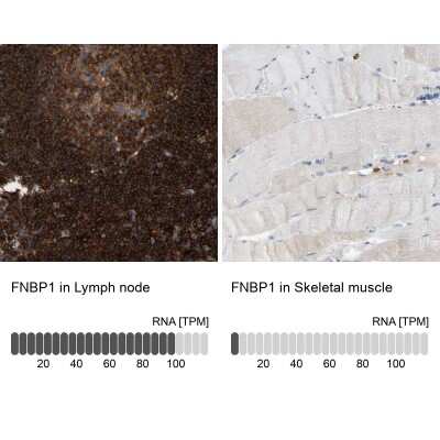 Immunohistochemistry-Paraffin: FNBP1 Antibody [NBP2-48542]