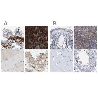 Immunohistochemistry-Paraffin: FNBP1 Antibody [NBP2-48542]