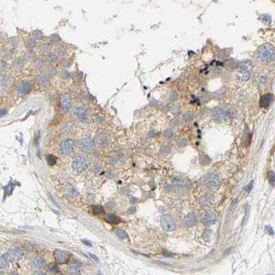 Immunohistochemistry-Paraffin: FNBP1 Antibody [NBP2-48542]