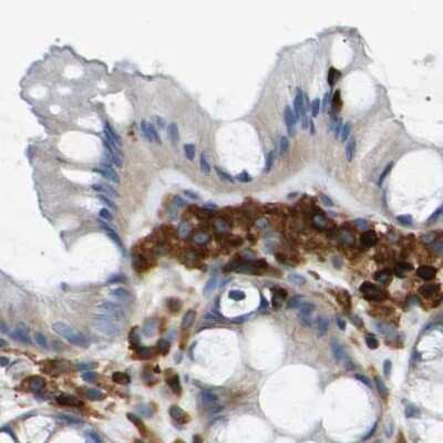 Immunohistochemistry-Paraffin: FNBP1 Antibody [NBP2-48542]