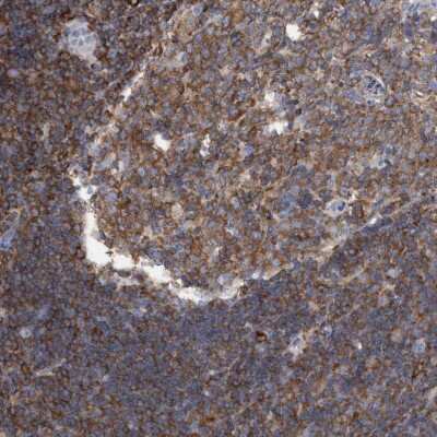 Immunohistochemistry-Paraffin: FNBP1 Antibody [NBP2-48556]