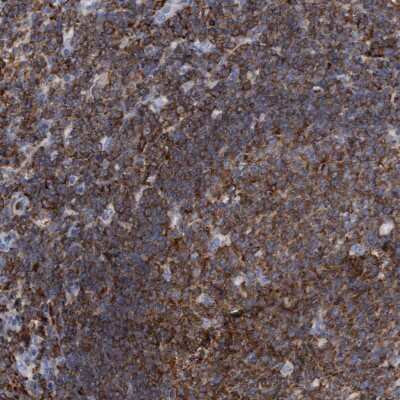 Immunohistochemistry-Paraffin: FNBP1 Antibody [NBP2-48556]