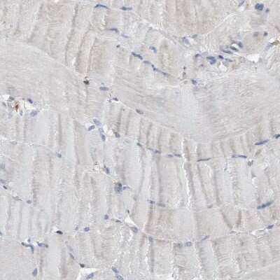 Immunohistochemistry-Paraffin: FNBP1 Antibody [NBP2-48556]