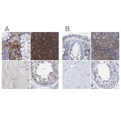 Immunohistochemistry-Paraffin: FNBP1 Antibody [NBP2-48556]