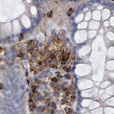 Immunohistochemistry-Paraffin: FNBP1 Antibody [NBP2-48556]