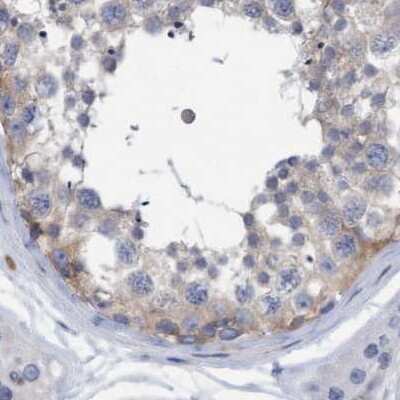 Immunohistochemistry-Paraffin: FNBP1 Antibody [NBP2-48556]