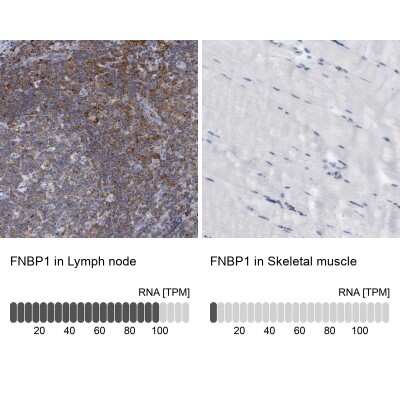 Immunohistochemistry-Paraffin: FNBP1 Antibody [NBP2-62603]