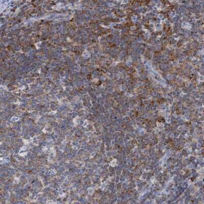 Immunohistochemistry-Paraffin: FNBP1 Antibody [NBP2-62603]