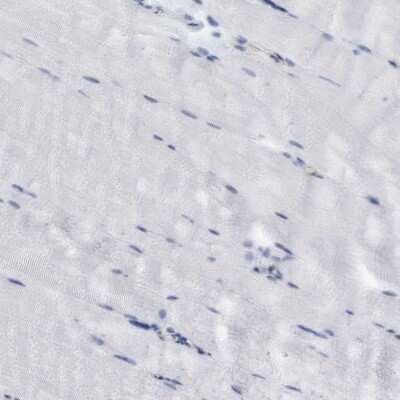 Immunohistochemistry-Paraffin: FNBP1 Antibody [NBP2-62603]