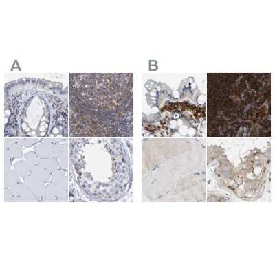 Immunohistochemistry-Paraffin: FNBP1 Antibody [NBP2-62603]