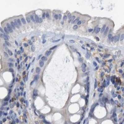 Immunohistochemistry-Paraffin: FNBP1 Antibody [NBP2-62603]