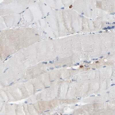 Western Blot: FNBP1 Antibody [NBP2-48542]