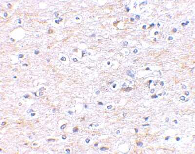 Immunohistochemistry-Paraffin: FNBP1L Antibody - BSA Free [NBP1-76846]