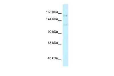 Western Blot: FNBP3 Antibody [NBP2-87455]