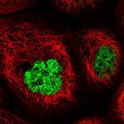 Immunocytochemistry/ Immunofluorescence: FNBP4 Antibody [NBP2-14022]