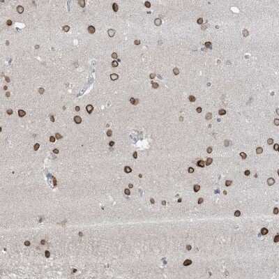 Immunohistochemistry-Paraffin: FNDC1 Antibody [NBP2-48602]