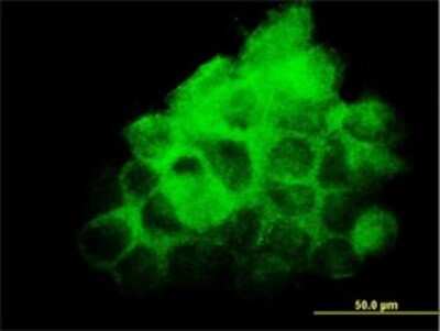 Immunocytochemistry/ Immunofluorescence: FNDC3A Antibody (2H4) [H00022862-M01]