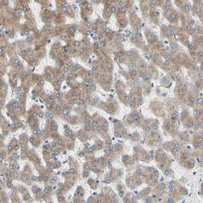 Immunohistochemistry-Paraffin: FNDC3A Antibody [NBP1-88809]