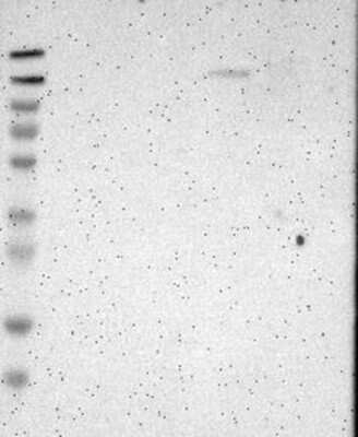 Western Blot: FNDC3A Antibody [NBP3-17849]