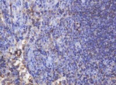 Immunohistochemistry: FNDC4 Antibody (OTI1B7) [NBP2-45691]