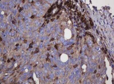 Immunohistochemistry: FNDC4 Antibody (OTI1B7) - Azide and BSA Free [NBP2-72151]