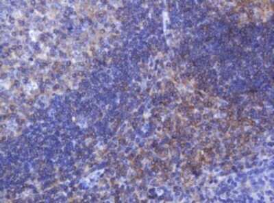 Immunohistochemistry: FNDC4 Antibody (OTI1B7) - Azide and BSA Free [NBP2-72151]