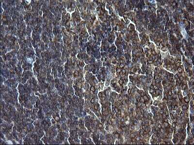 Immunohistochemistry: FNDC8 Antibody (OTI1C10) [NBP2-45692]