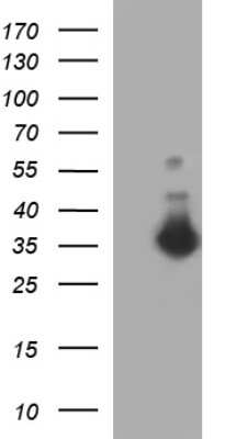 Western Blot: FNDC8 Antibody (OTI1C10) [NBP2-45692]