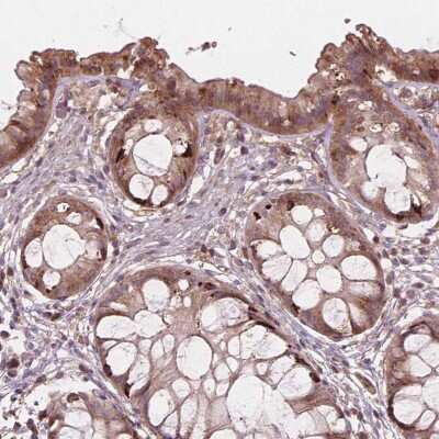 Immunohistochemistry: FNIP1 Antibody [NBP2-49544]