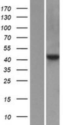 Western Blot: FNTA Overexpression Lysate [NBP2-08153]