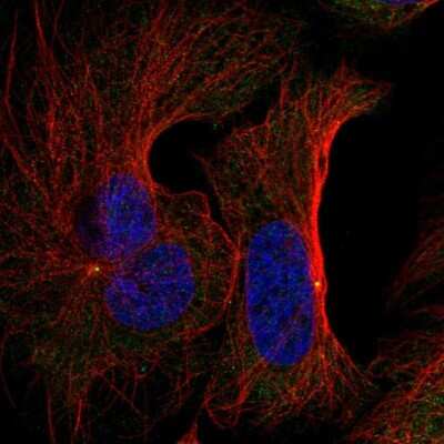 Immunocytochemistry/ Immunofluorescence: FNTB Antibody [NBP2-38002]