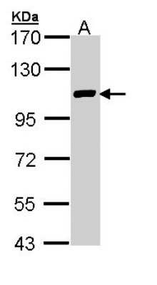 Western Blot: FOG2 Antibody [NBP1-32895]