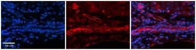 Immunohistochemistry: FOLR1 Antibody [NBP1-69363]