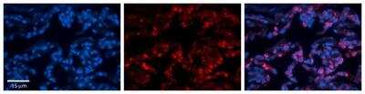 Immunohistochemistry-Paraffin: FOLR1 Antibody [NBP1-69363]