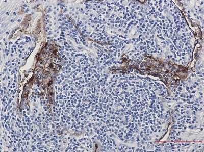 Immunohistochemistry-Paraffin: FOLR1 Antibody (S02-3G2) [NBP3-19954]