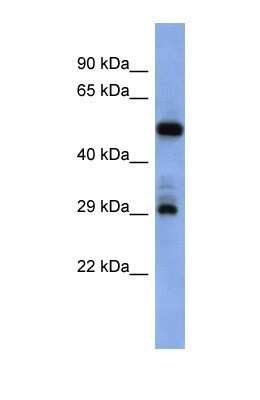 Western Blot: FOLR1 Antibody [NBP1-69363]