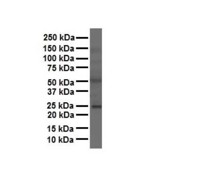 Western Blot: FOLR1 Antibody [NBP1-69363]