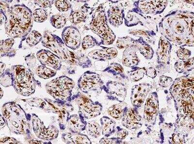 Immunohistochemistry-Paraffin: FOLR2 Antibody (001) [NBP2-89846]