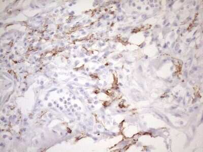 Immunohistochemistry: FOLR2 Antibody (OTI4G6) - Azide and BSA Free [NBP2-70763]