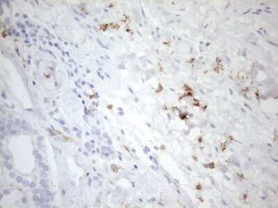 Immunohistochemistry: FOLR2 Antibody (OTI4G6) - Azide and BSA Free [NBP2-70763]