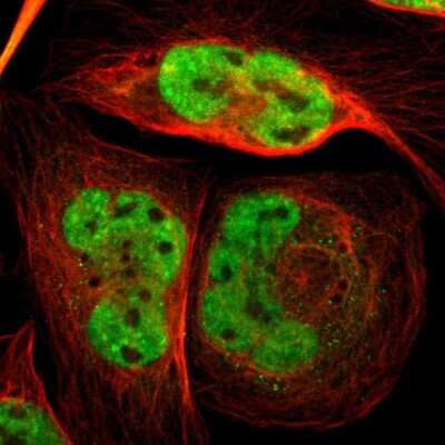 Immunocytochemistry/ Immunofluorescence: FOX2 Antibody [NBP1-91910]