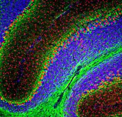 Immunocytochemistry/ Immunofluorescence: FOX2 Antibody [NBP3-05534]