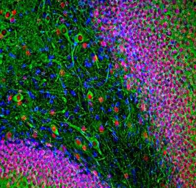 Immunocytochemistry/ Immunofluorescence: FOX2 Antibody [NBP3-05534]